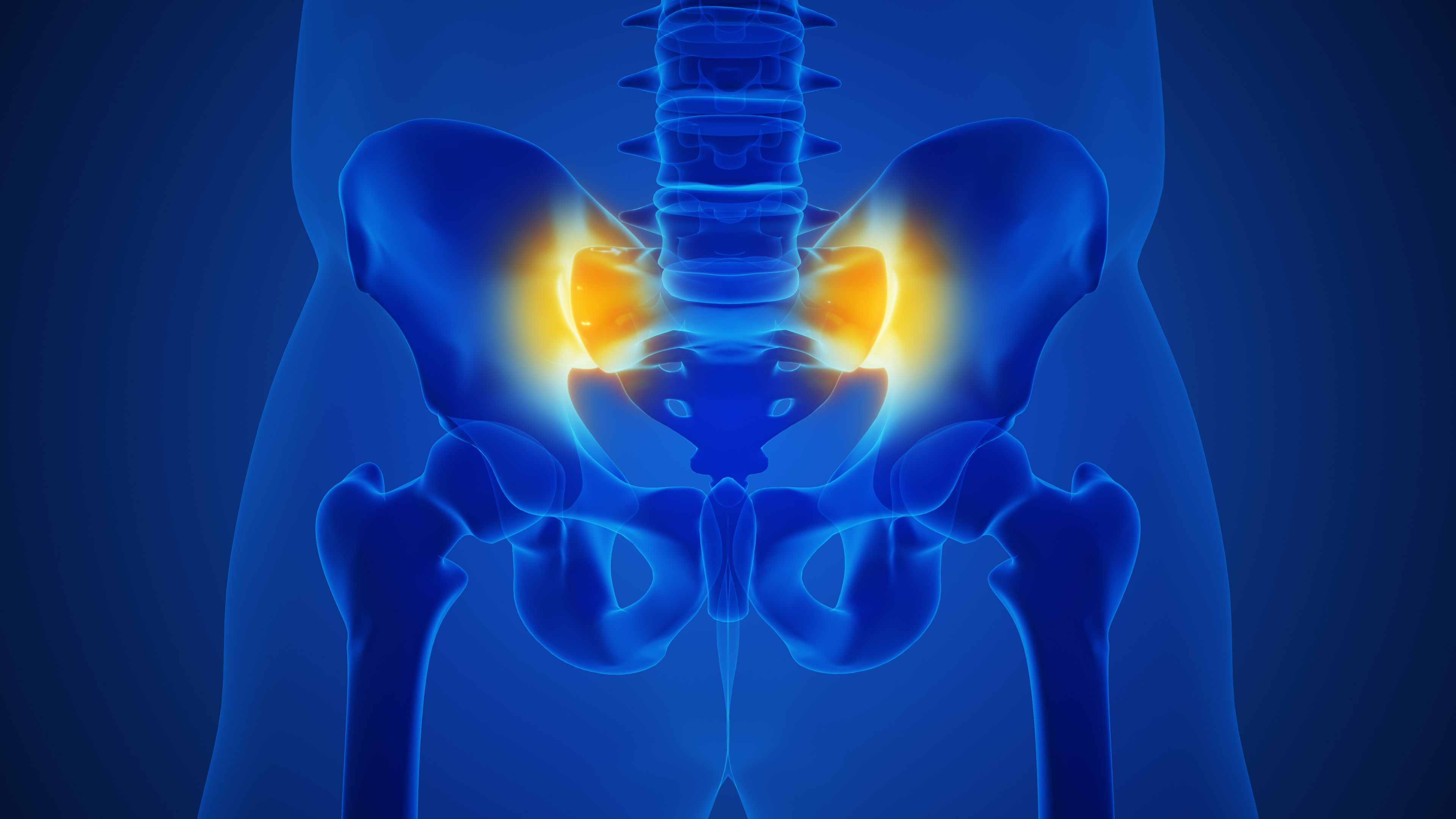 Tratamiento de ciática y dolor radicular lumbar en Guadalajara