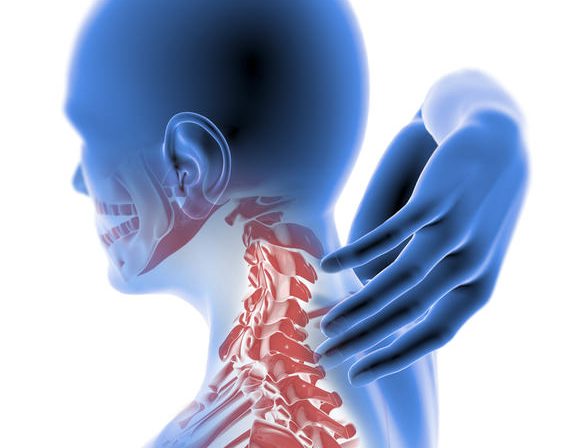 Tratamiento de radiculopatía cervical en Guadalajara